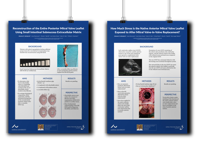 Plakater til præsentation af medicinske forskningsresultater for hjerteklapkirurgi